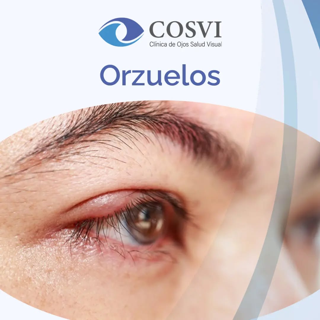 Orzuelo y cuidado del párpado